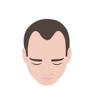 Stage 2